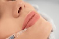 Dermal Fillers 