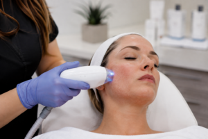 Treatment for Melasma