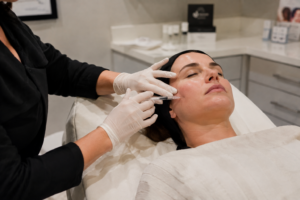 Dermal Fillers